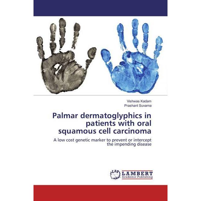 Palmar dermatoglyphics in patients with oral squamous cell carcinoma, Fachbücher von Vishwas Kadam, Prashant Suvarna