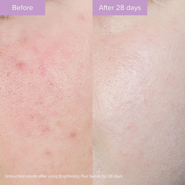 Immagine prodotto The Organic Pharmacy Brightening Plus Serum (35 ml)