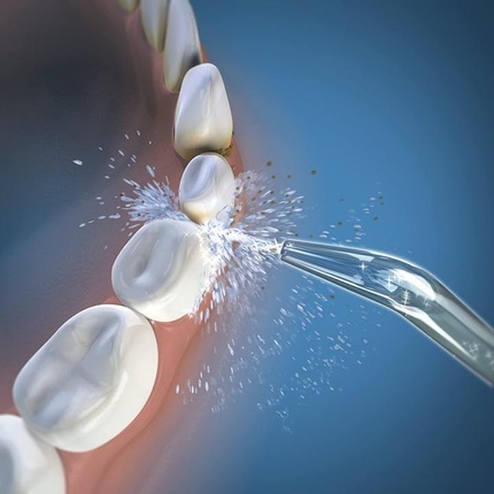 Immagine prodotto Waterpik Sbiancamento classico (Accessori per irrigatori orali)