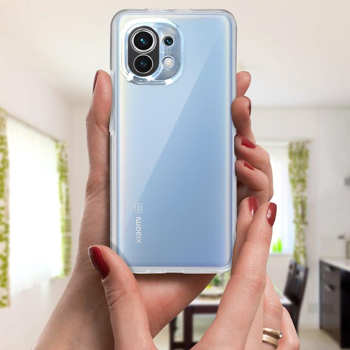 Immagine prodotto Avizar Serie integrale (Xiaomi Mi 11 5G)