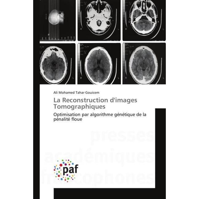 La Reconstruction d'images Tomographiques, Fachbücher