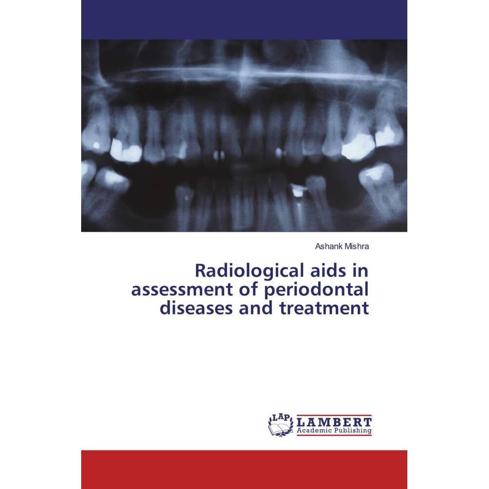Radiological aids in assessment of periodontal diseases and treatment, Fachbücher von Ashank Mishra