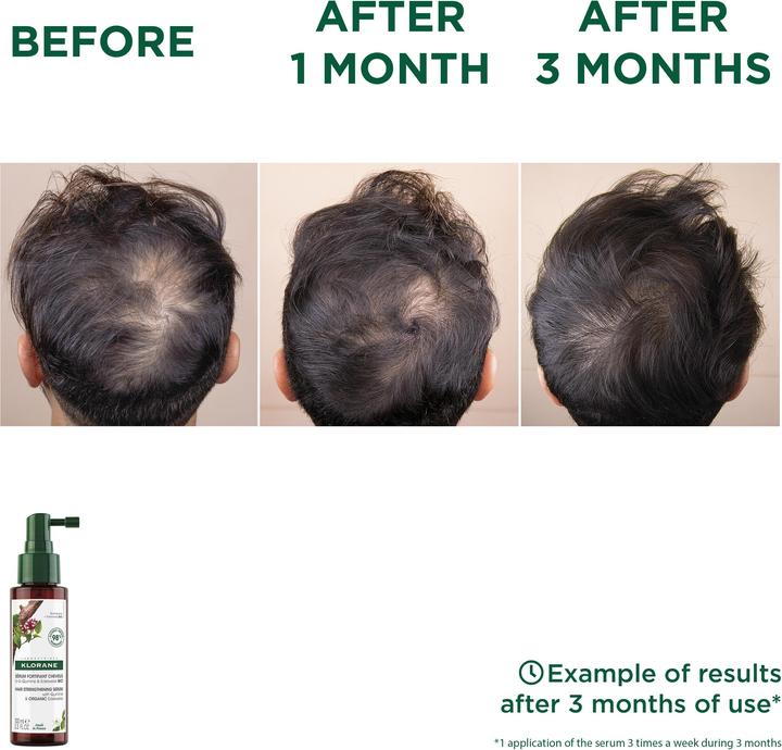 Immagine prodotto Klorane Siero contro la caduta dei capelli (100 ml)