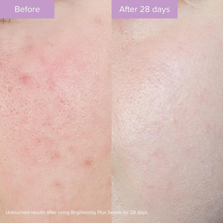 Image du produit The Organic Pharmacy Rose Plus Brightness Complex (35 ml)