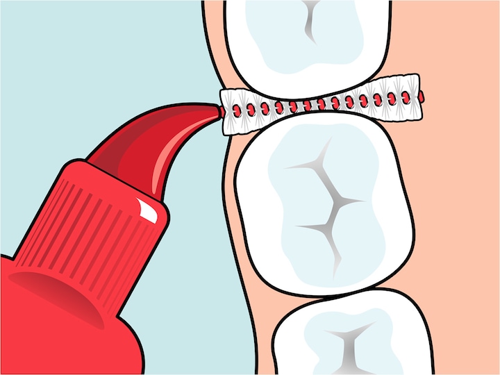 Actual product image TePe Interdental brushes Original ISO 2 (20 x, 0.50 mm)