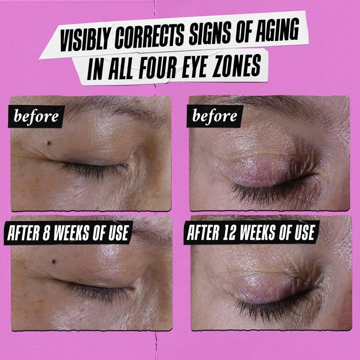 Image du produit Kiehl's Super Multi-Corrective Eye Zone Treatment (Gel pour le soin des yeux, Jour + nuit, 14 ml)