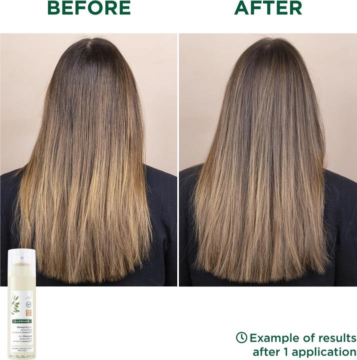 Actual product image Klorane Ultra-Gentle (150 ml, Dry shampoo)