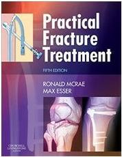 Produktbild Practical Fracture Treatment (Englisch, Max Esser, 2008)