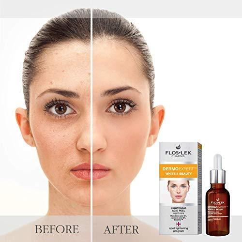 Actual product image Floslek facial scrub Pharma Dermo Expert White & Beauty whitening 30 ml (30 ml)