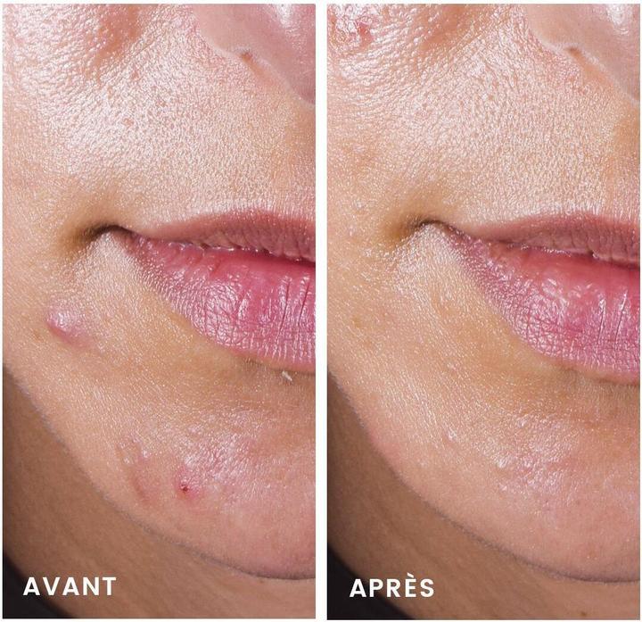Actual product image Avène Avene Cleanance Comedomed Disp 30 ml (30 ml, 24h cream)