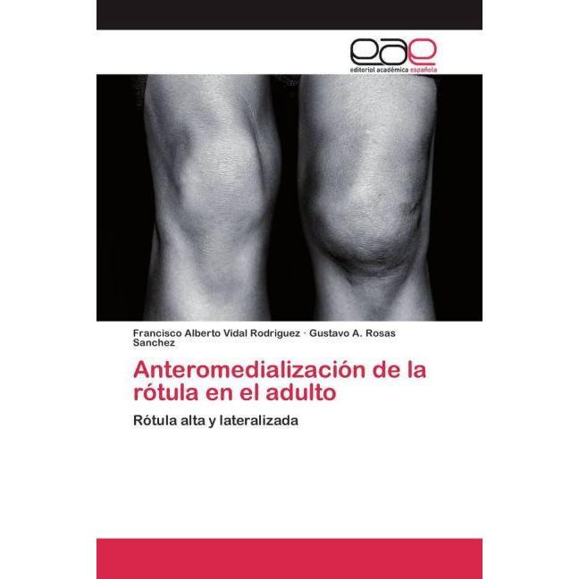 Anteromedialización de la rótula en el adulto, Fachbücher
