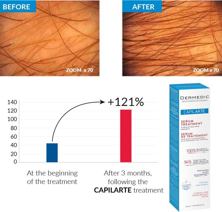 Actual product image Dermedic Capilarte (150 ml)