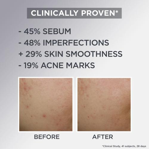Actual product image Garnier Pure Active AHA + BHA Charcoal Daily Mattifying Air Cream (50 ml, Day cream)