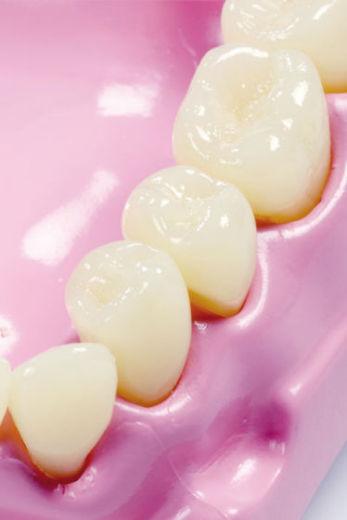 Immagine prodotto Betzold Modello masticatorio e dentale