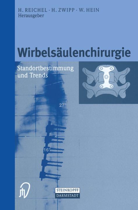 Produktbild Wirbelsäulenchirurgie (Deutsch, 2012)