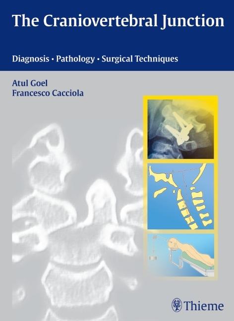Produktbild The Craniovertebral Junction (Englisch, Atul Goel, Francesco Cacciola, 2011)