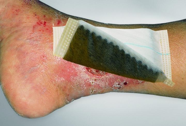 Produktbild Vliwaktiv Ag Aktivkohle Verband steril