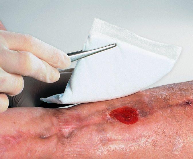 Lohmann & Rauscher Saugkompresse 20x20cm steril