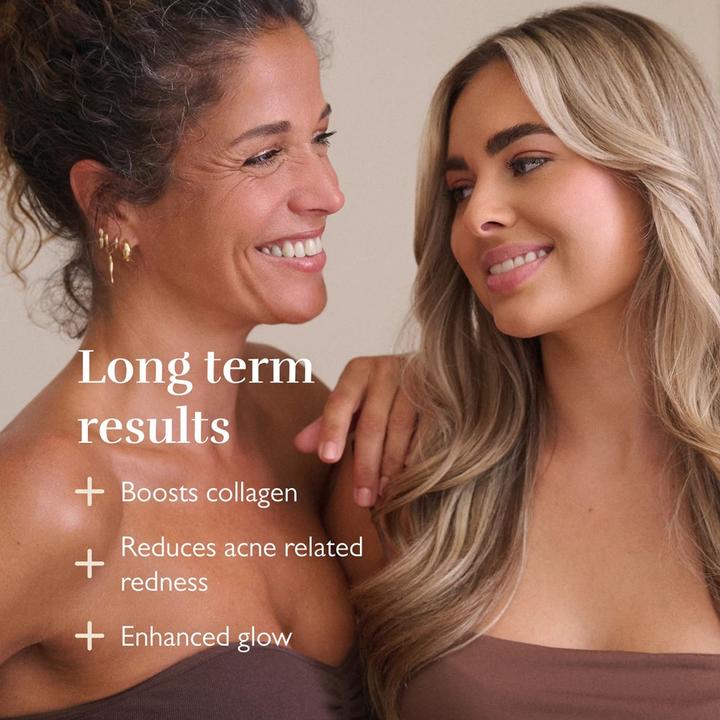 Actual product image Silk'n Face Mask Pro