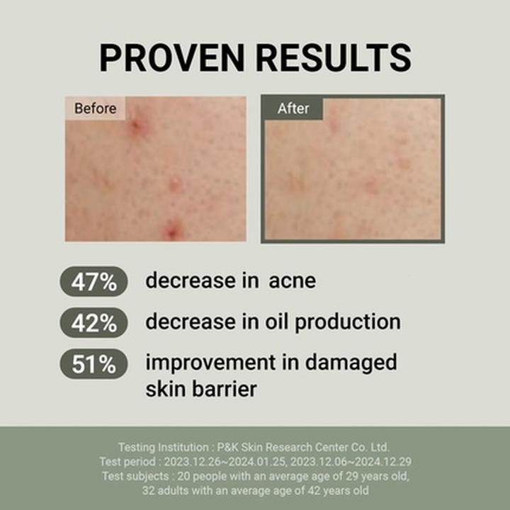 Actual product image Jumiso Snail Mucin 88 and Peptide Cream for Sensitive Skin (1000 ml, Day cream)