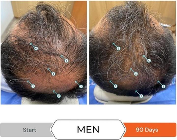 Image du produit DS Laboratories Shampooing contre la chute des cheveux Revita (shampooing stimulant) 925 ml (925 ml, Shampoing liquide)