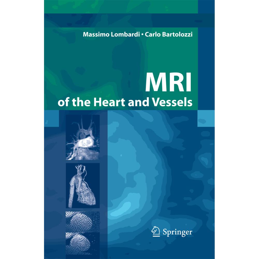 MRI of the Heart and Vessels, Fachbücher von Massimo Lombardi, Carlo Bartolozzi