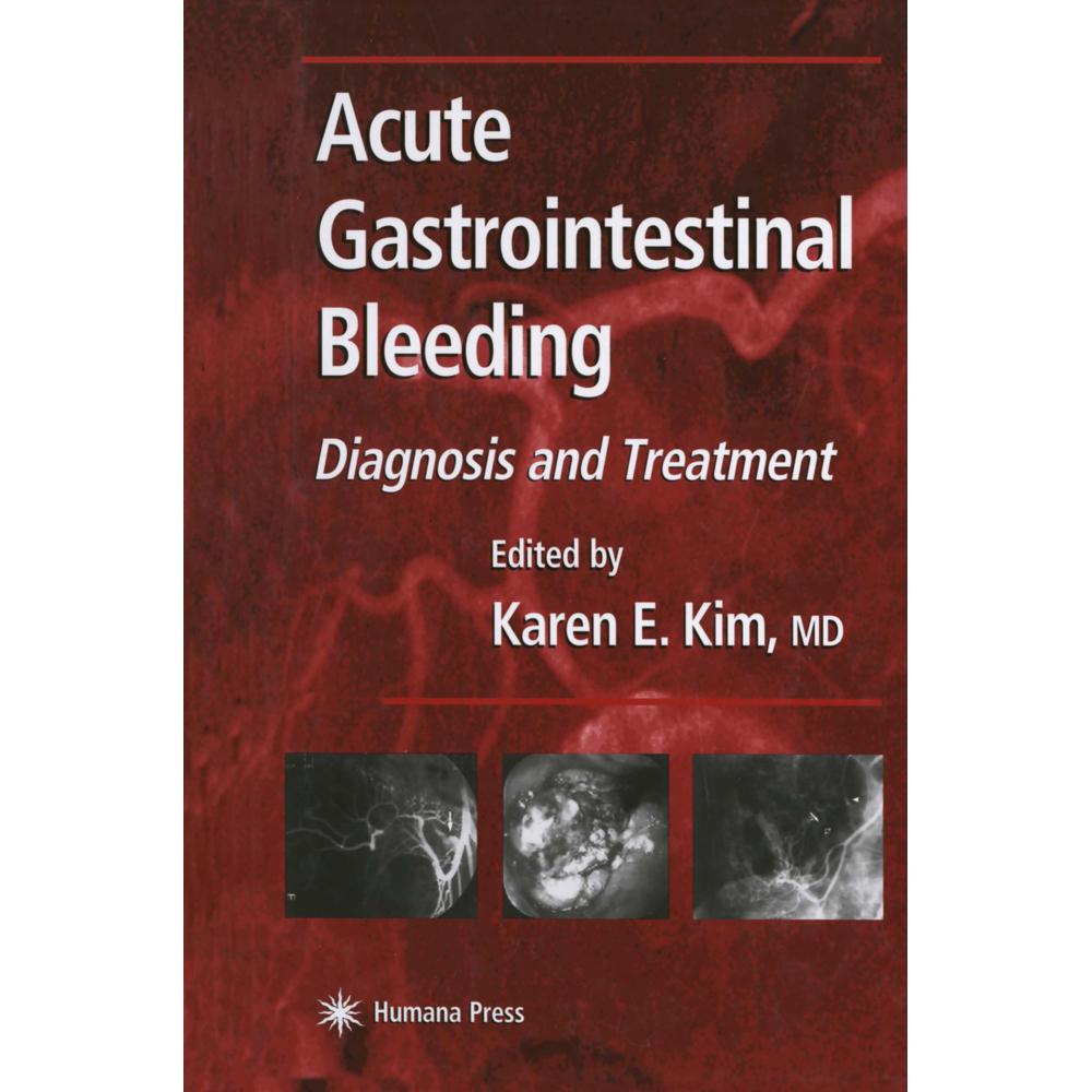 Acute Gastrointestinal Bleeding, Fachbücher von Karen E. Kim