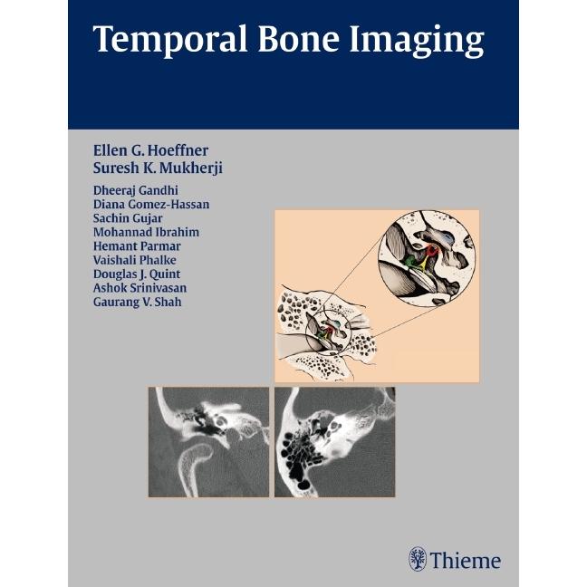 Hoeffner,E.G.:Temporal Bone Imaging, Fachbücher von Thieme Publishers New York