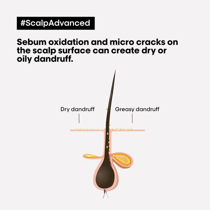 Actual product image L'Oréal Paris L'Oréal Professionnel - (Anti-Dandruff Dermo Clarifier Shampoo) Scalp Advanced - Volume: 300 ml (Liquid shampoo, 300 ml)