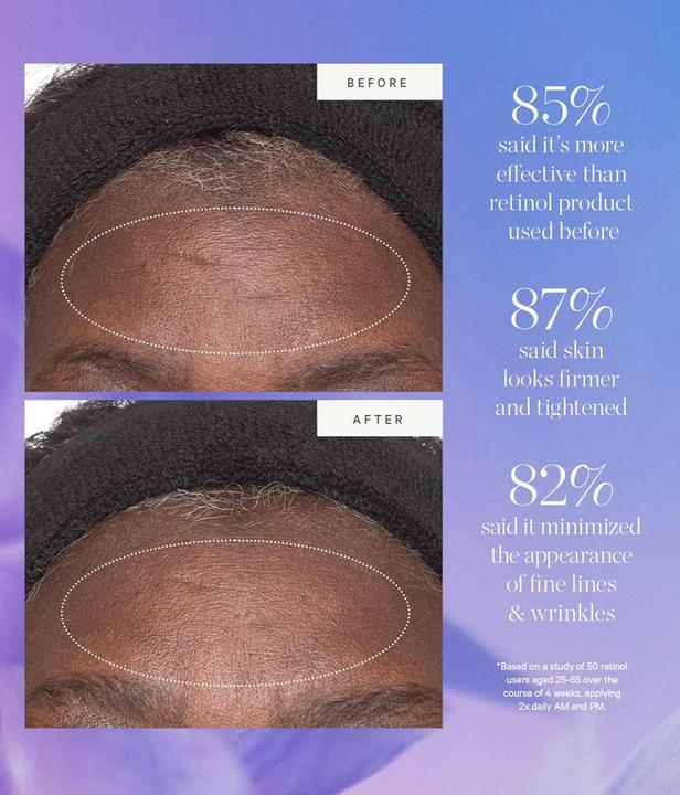 Actual product image Kora Organics Plant Stem Cell Retinol Alternative Moisturizer 1.69 fl oz Full-Size Jar (50 ml)