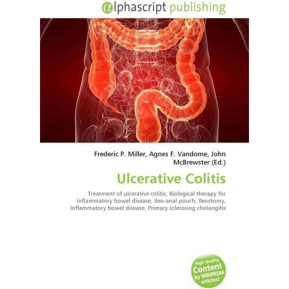 Ulcerative Colitis, Fachbücher von Agnes F. Vandome, Frederic P. Miller, John McBrewster