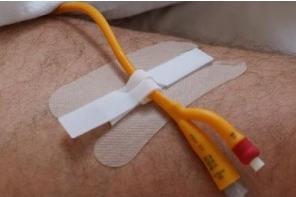 Immagine prodotto Secutape Set di fissaggio in pile 10 pezzi