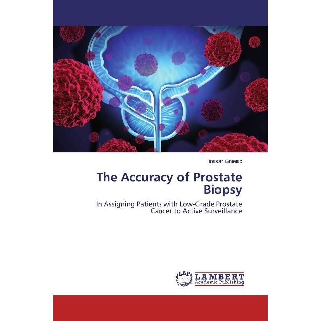The Accuracy of Prostate Biopsy, Fachbücher von Intisar Ghleilib