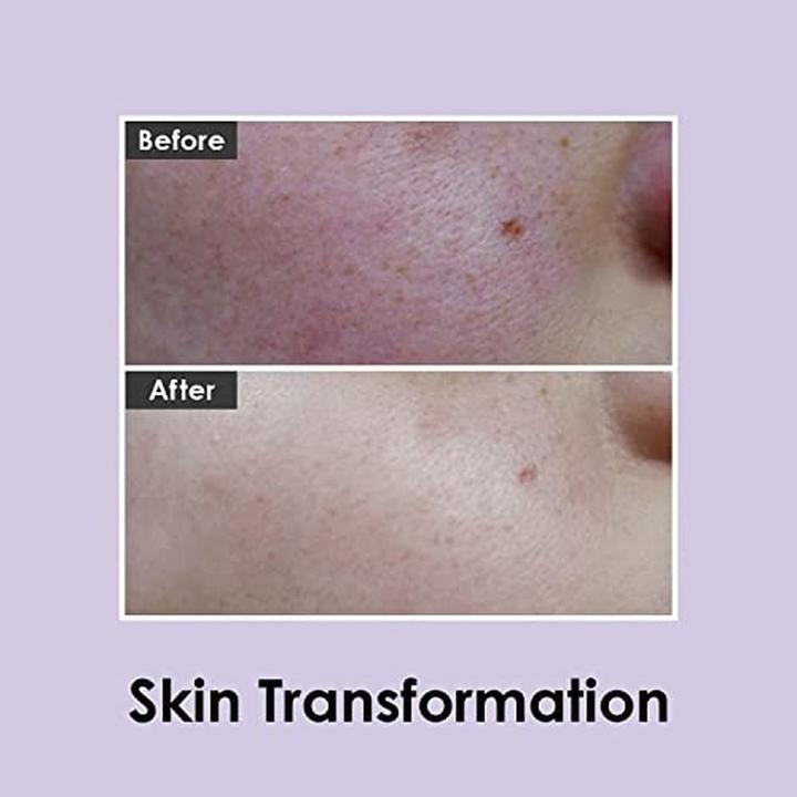 Actual product image Medi-Peel Medipeel Hyal Kombucha Tea Gift Cream 50ml (50 ml)