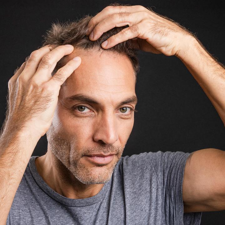 Actual product image Hairvest HAIR LOSS FORTE Intensive Treatment