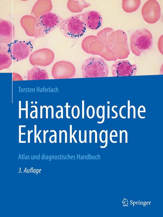 Actual product image Haferlach:Hämatologische Erkrankungen (German, Torsten Haferlach, 2020)