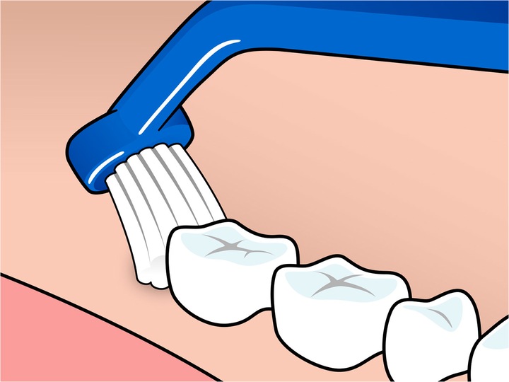 Actual product image TePe Universal Care Brush (1 x)