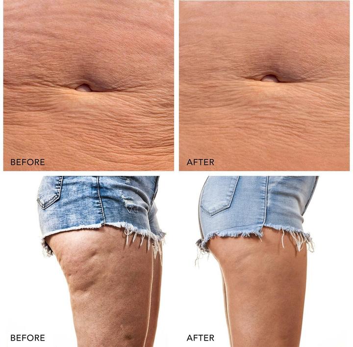 Produktbild Foreo Mikrostromgerät
