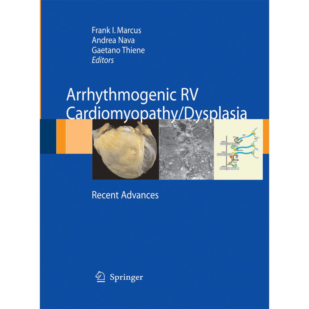 Arrhythmogenic RV Cardiomyopathy/Dysplasia, Fachbücher von Gaetano Thiene, Frank I. Marcus, Andrea Nava