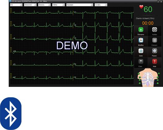 Actual product image Edan Resting ECG SE-1515 DX12 (Bluetooth)