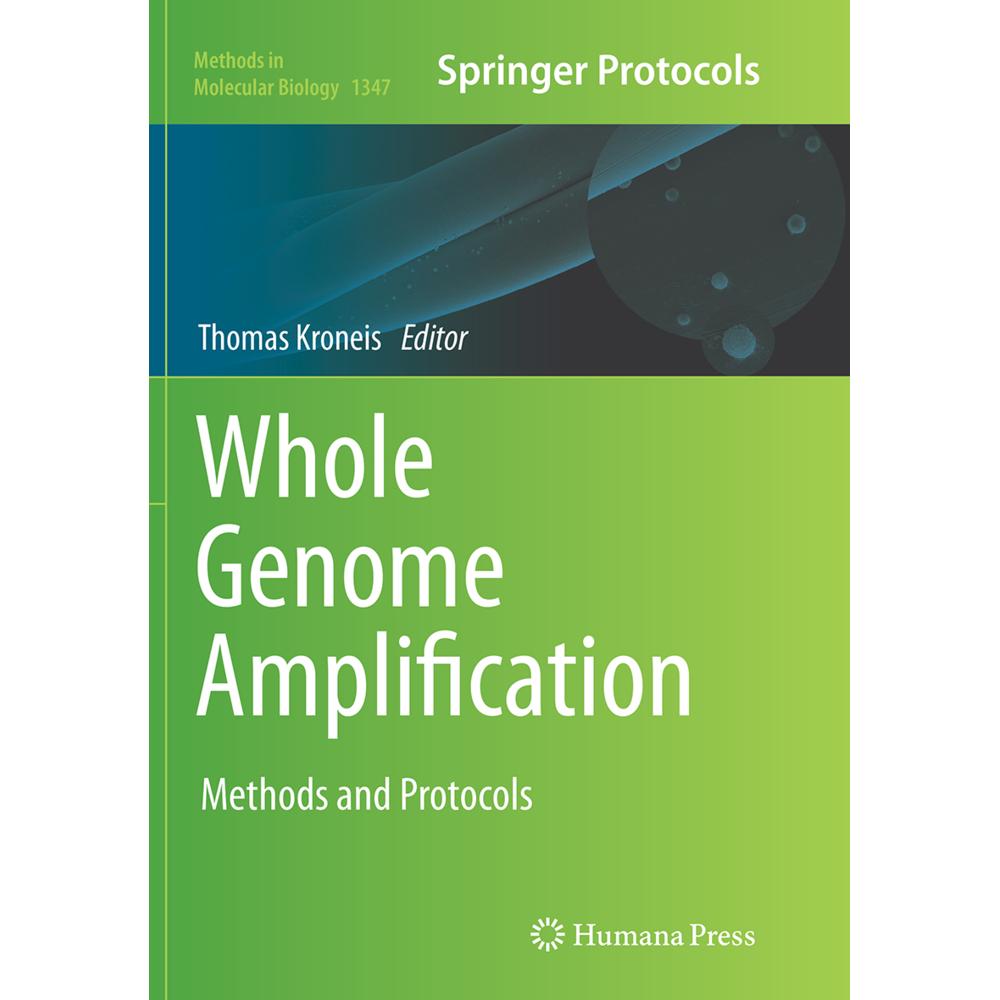 Whole Genome Amplification, Fachbücher von Thomas Kroneis