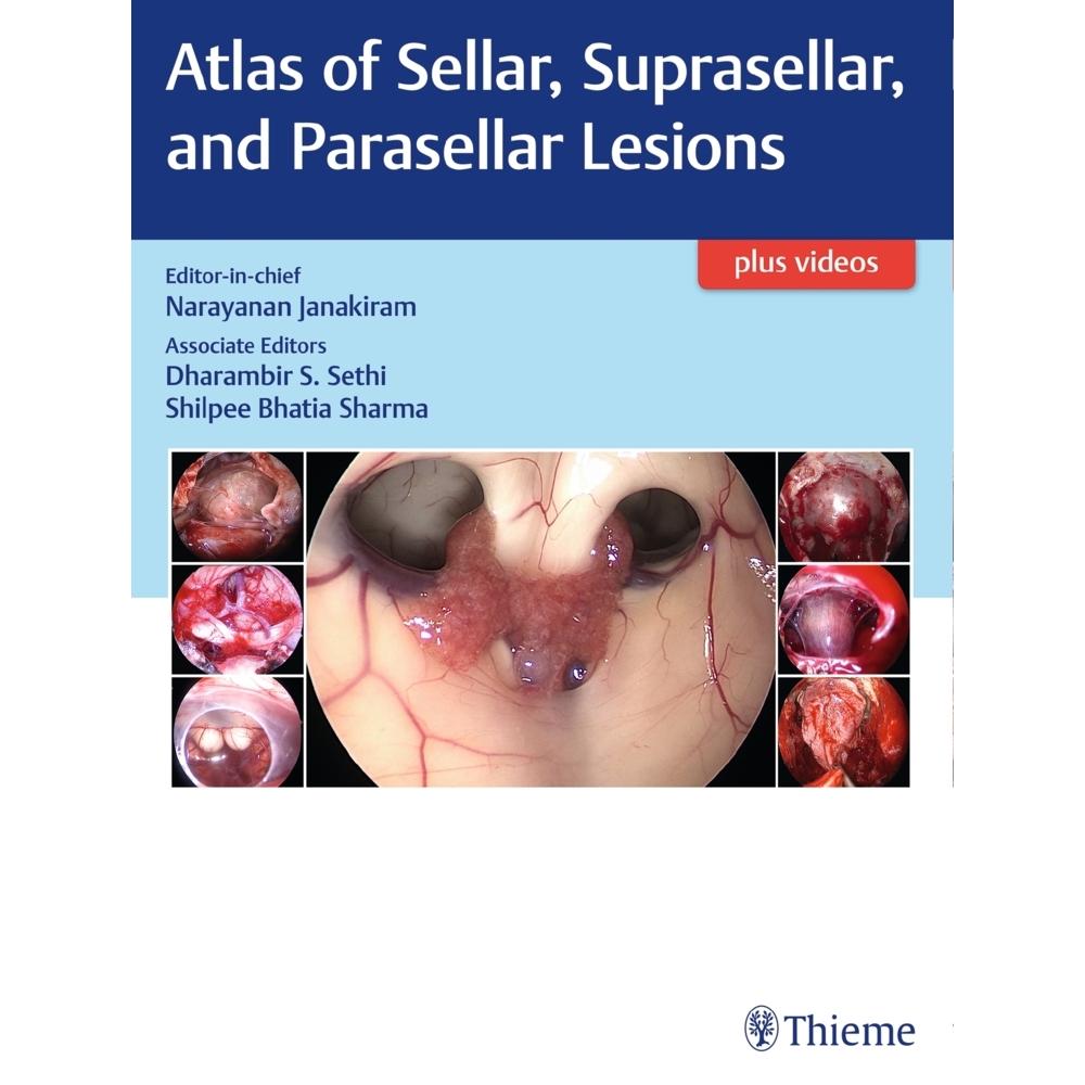 Atlas of Sellar, Suprasellar and Parase, Sachbücher von Narayanan Janakiram