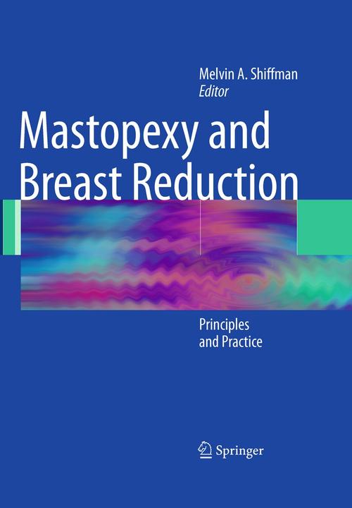 Produktbild Mastopexy and Breast Reduction (Englisch, 2009)