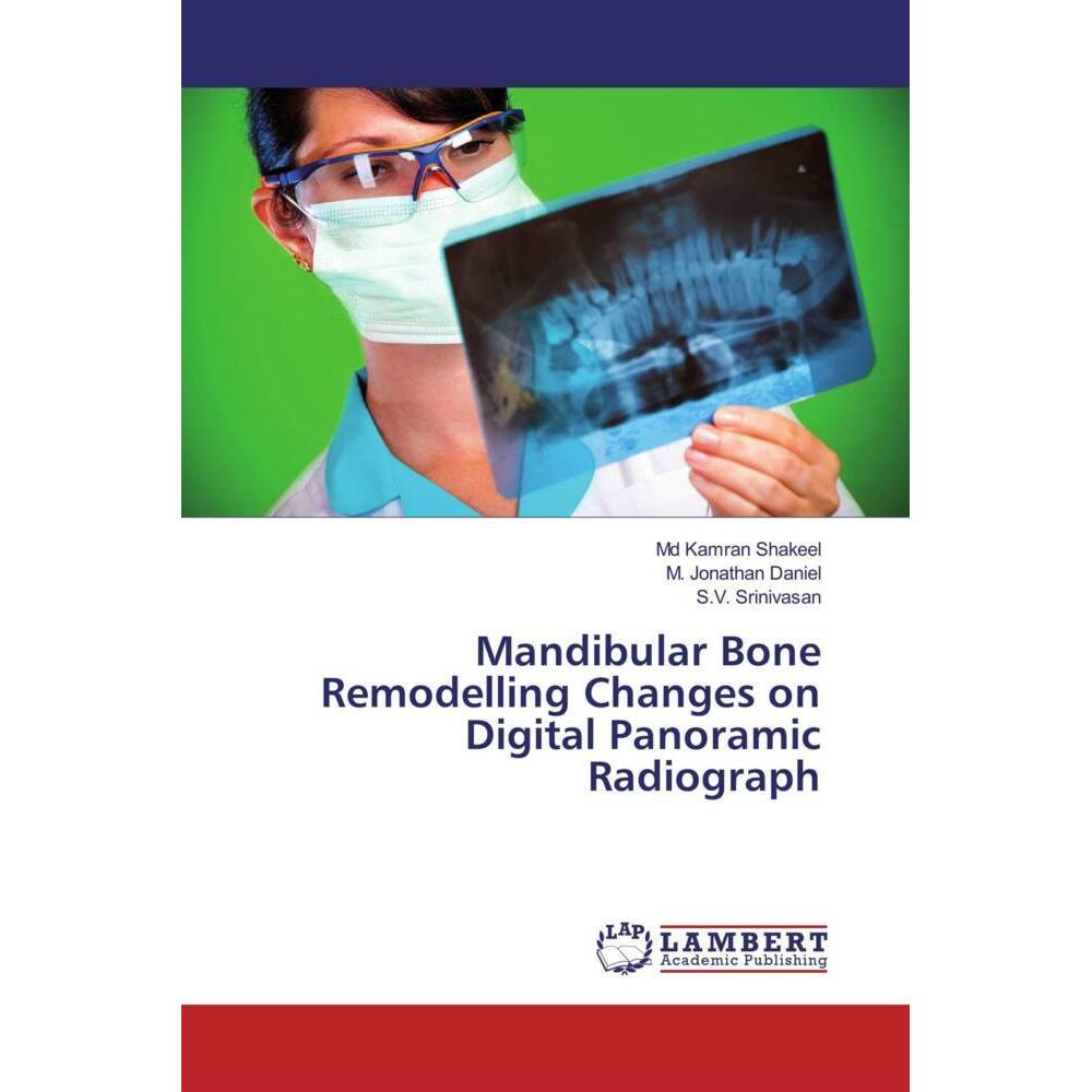 Mandibular Bone Remodelling Changes on Digital Panoramic Radiograph, Fachbücher von Md Kamran Shakeel, M. Jonathan Danie...