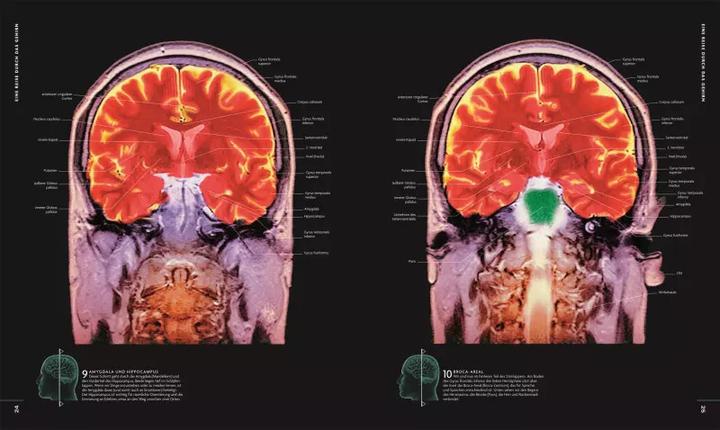 Actual product image Das Gehirn (German, Rita Carter, 2019)