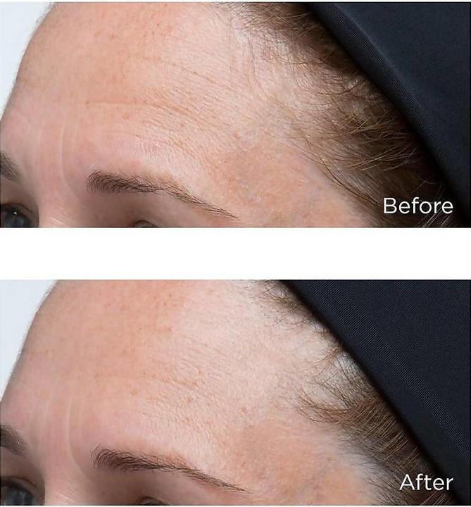 Actual product image Perricone MD High Potency Classics Hyaluronic Intensive Moisturizing Face Cream Women Gel 30 ml (30 ml, Face gel, Day cream)