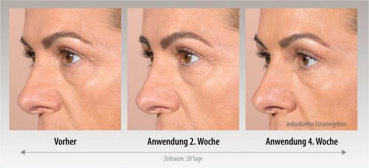 Actual product image And Shine - The Youth Patch (8 ml)