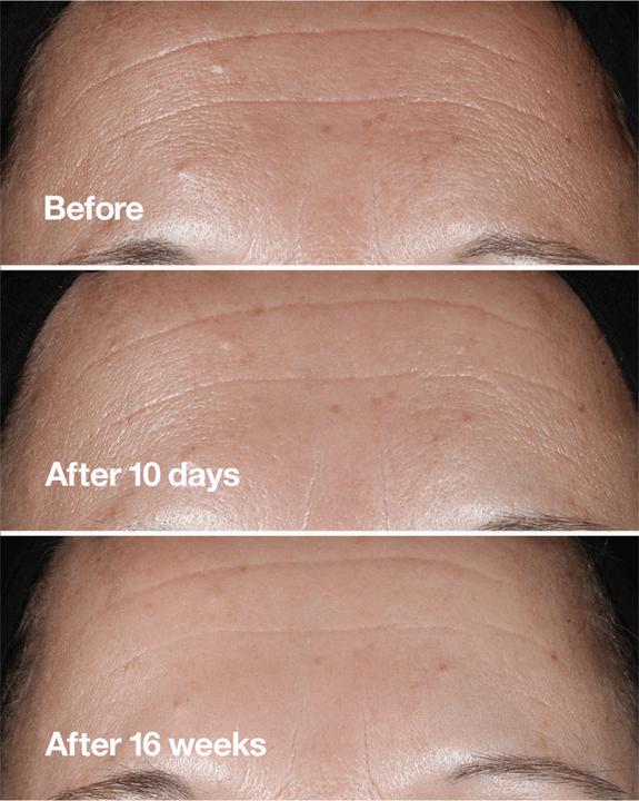 Produktbild Clinique Smart Clinical Repair (100 ml)