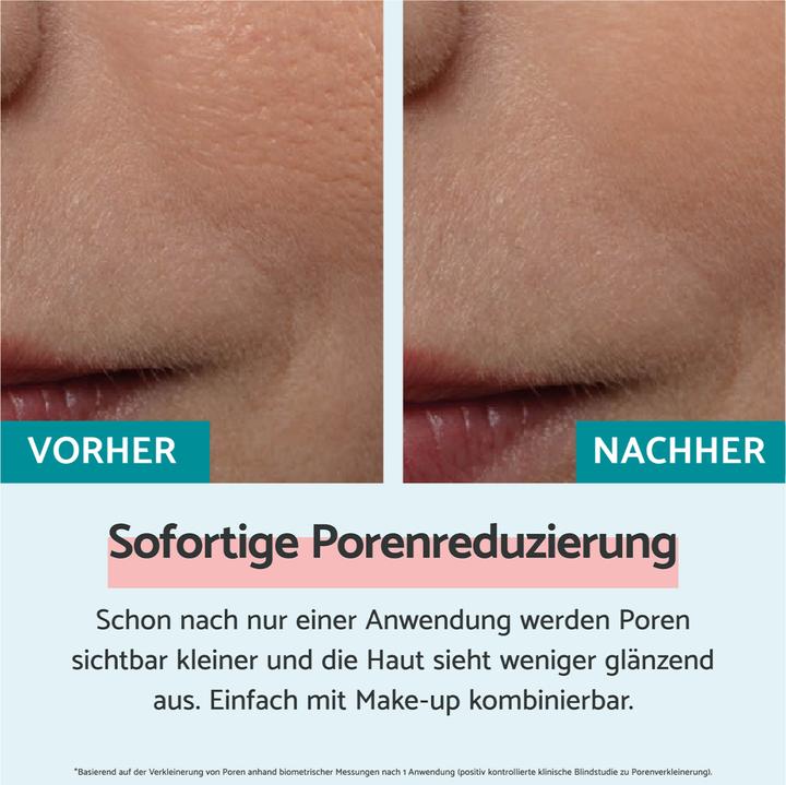 Image du produit Remescar Réduction instantanée des pores (20ml) (20 ml, Crème de jour)