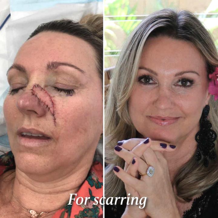 Image du produit Eco by Sonya Huile Glory (30 ml, Huile visage)